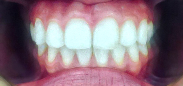 aclinic_after